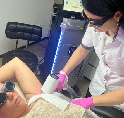 Permanente laserontharing